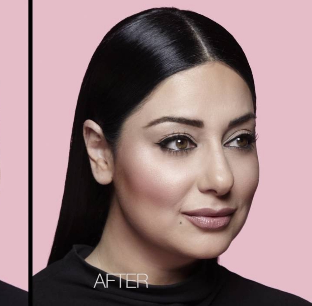 NARS- The Multiple- Copacabana - Picture 5 of 7